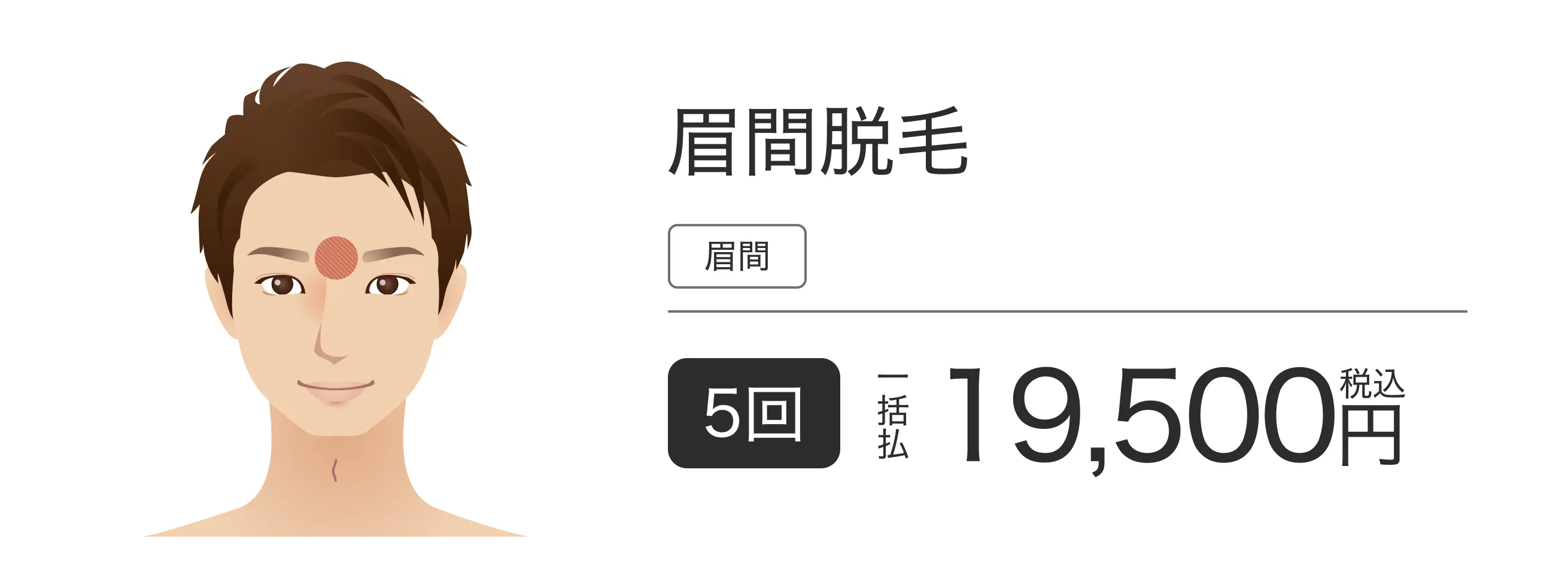 眉間脱毛 5回 一括払 税込 19,500円
