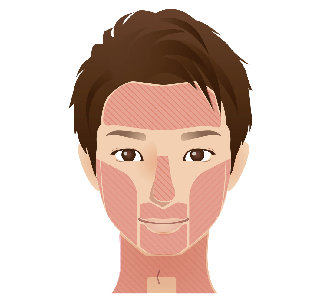 顔の脱毛部位