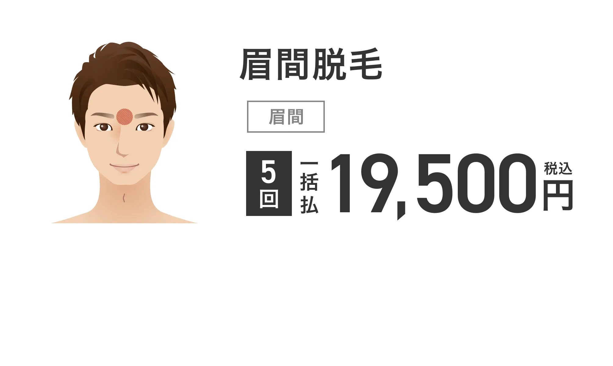眉間脱毛 5回 一括払 税込 19,500円