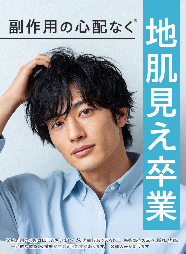 副作用の心配なく地肌見え卒業