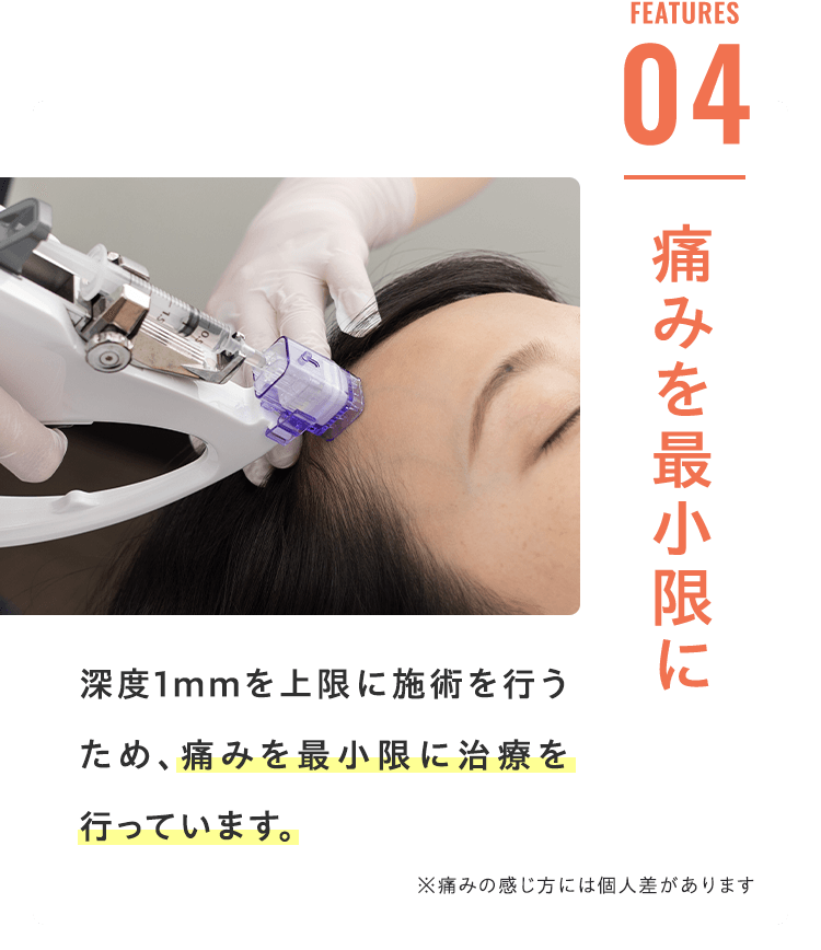 Features 04 痛みを最小限に 深度1mmを上限に施術を行うため、痛みを最小限に治療を行っています。