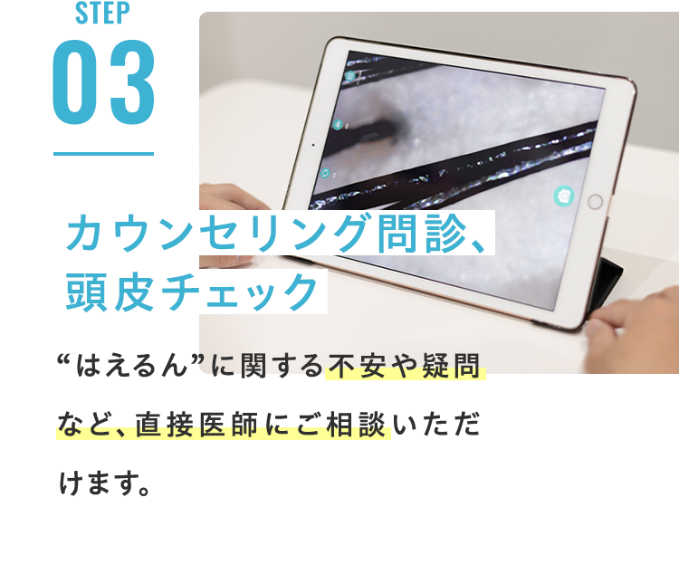 STEP03 カウンセリング問診、 頭皮チェック HCE治療に関する不安や疑問など、直接医師にご相談いただけます。