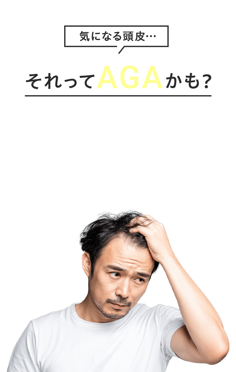 気になる頭皮…それってAGAかも?