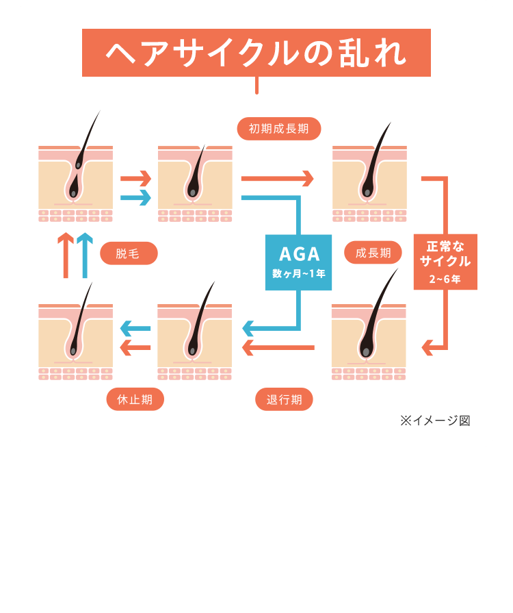 ヘアサイクルの乱れ
