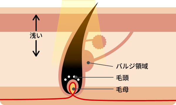 エステ脱毛の仕組み