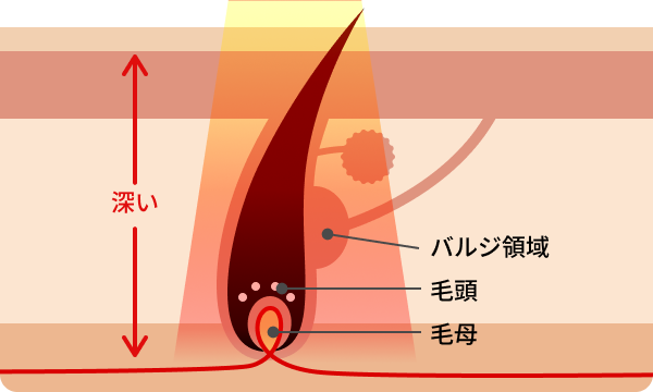 医療脱毛の仕組み