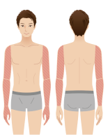 腕脱毛