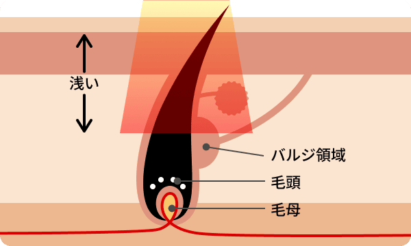 エステ脱毛の仕組み