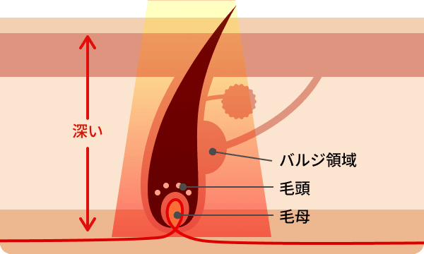 医療脱毛の仕組み