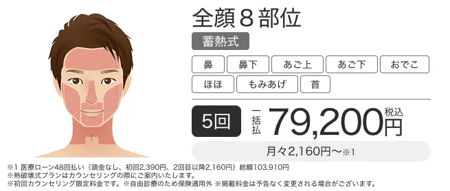 ヒゲ脱毛・顔脱毛 全体8部位 5回一括払 税込79,200円