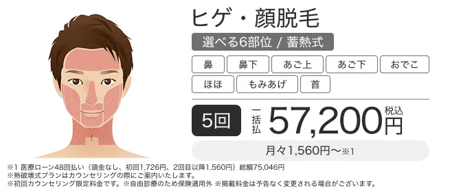 ヒゲ脱毛・顔脱毛(選べる6部位) 5回 一括払税込57,200円