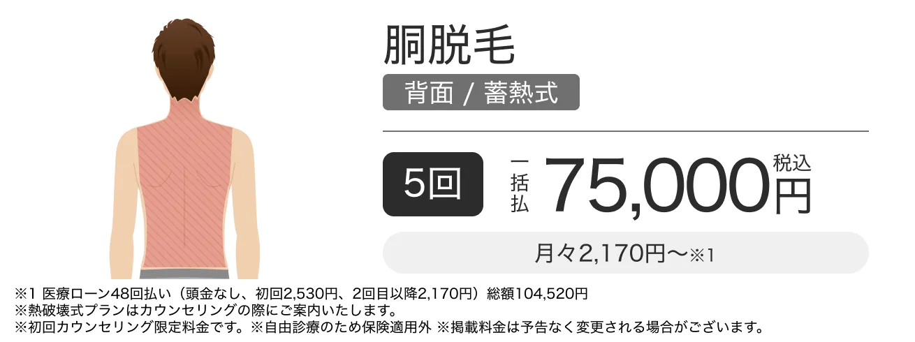 胴脱毛（背面）の料金バナー