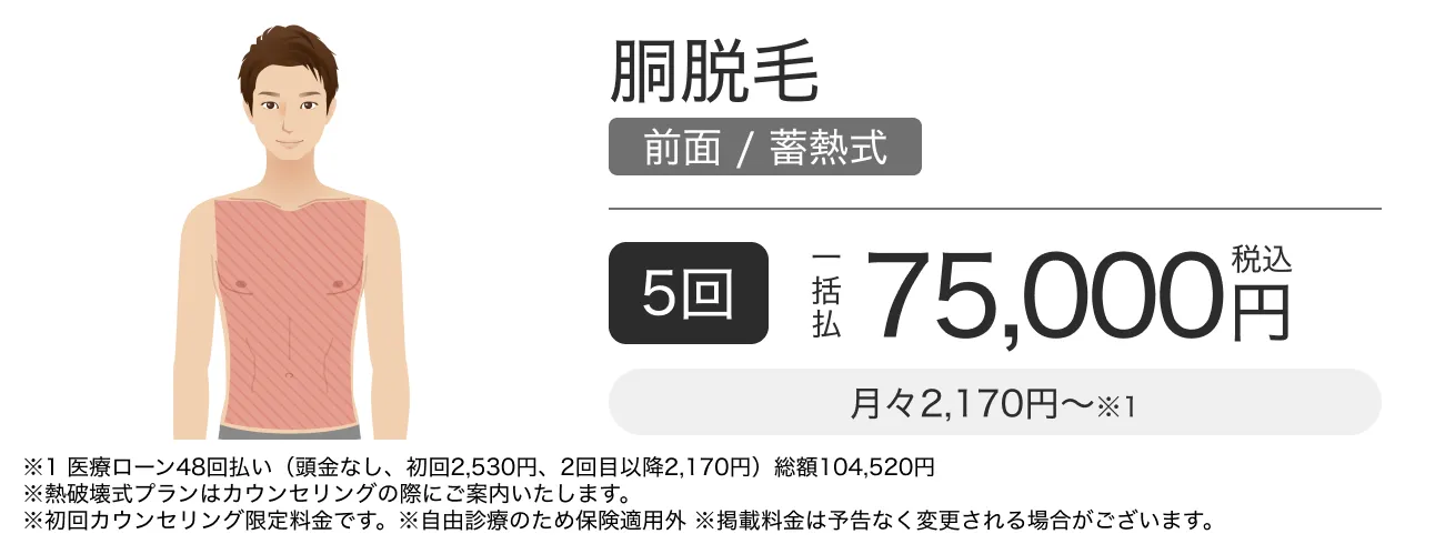 胴脱毛（前面）の料金バナー