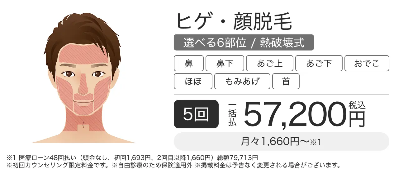 ヒゲ脱毛・顔脱毛(選べる6部位) 5回 一括払税込57,200円