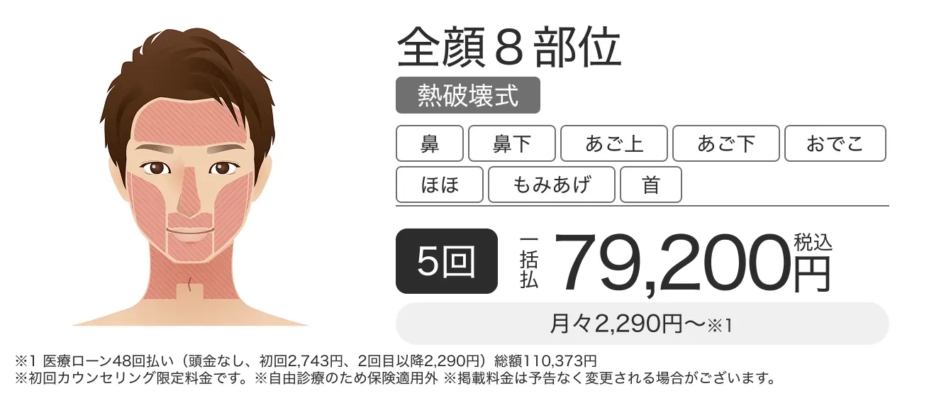 ヒゲ脱毛・顔脱毛 全体8部位 5回一括払 税込79,200円